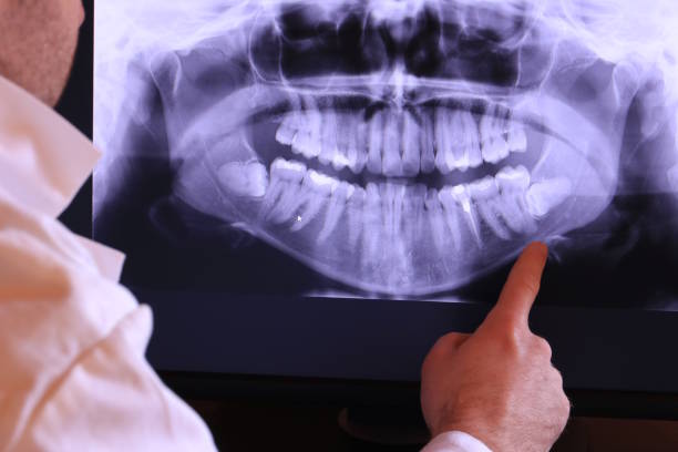 Best Same-Day Emergency Dentist in Bort, GA