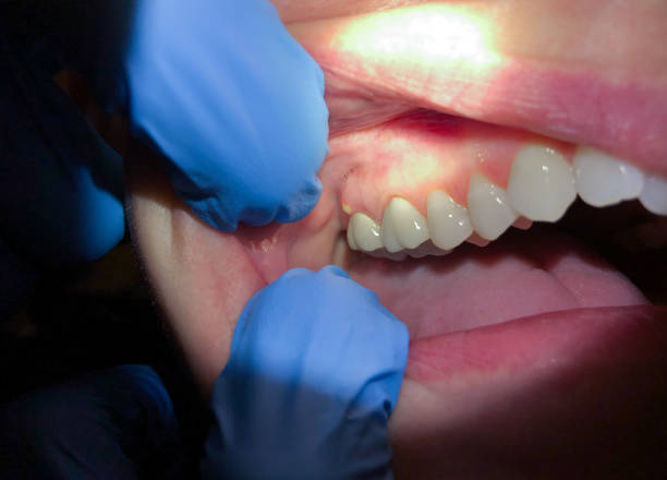 Best Emergency Dental Care for Trauma or Injury in Bort, GA