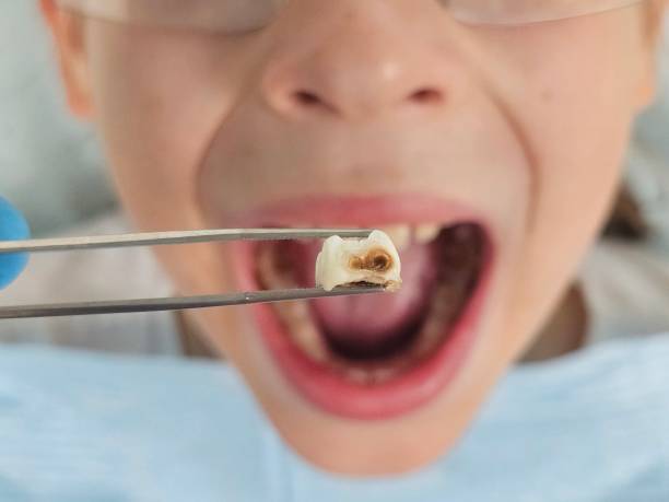 Best Emergency Orthodontic Repairs in Bort, GA